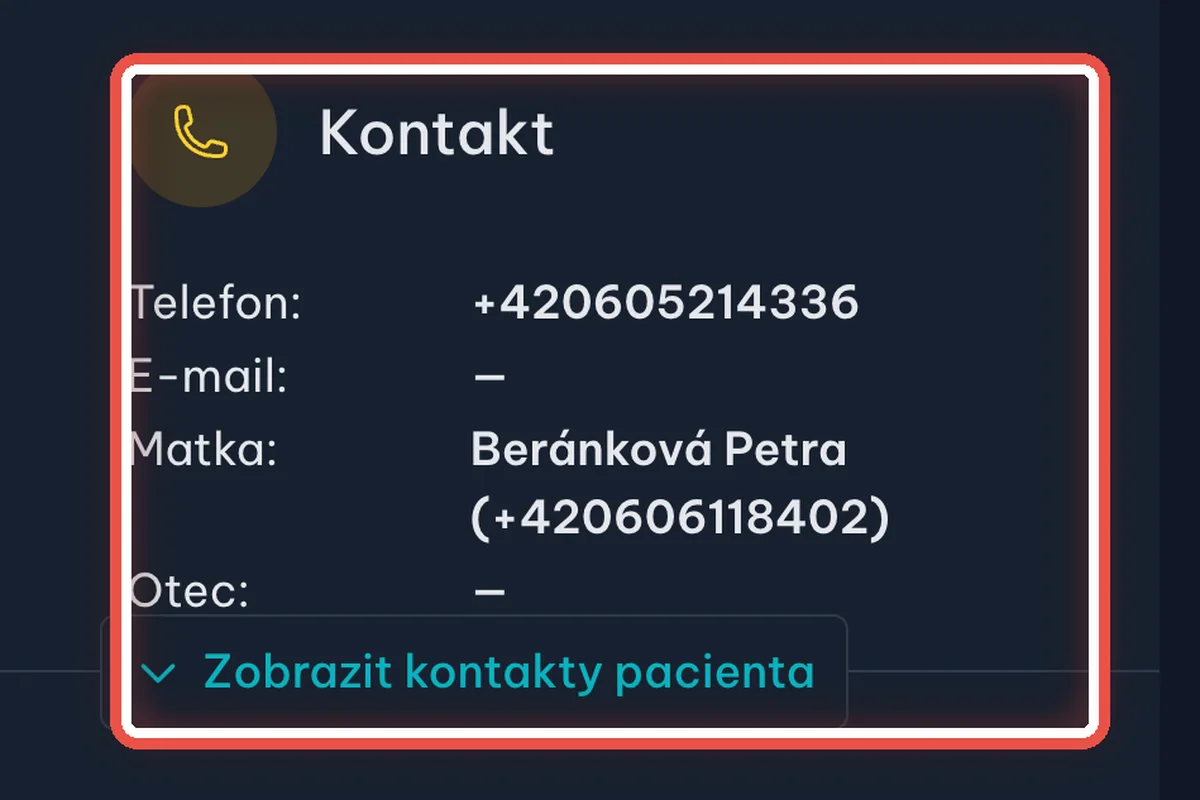Část Kontakt — zvětšené místo, kam se dívat