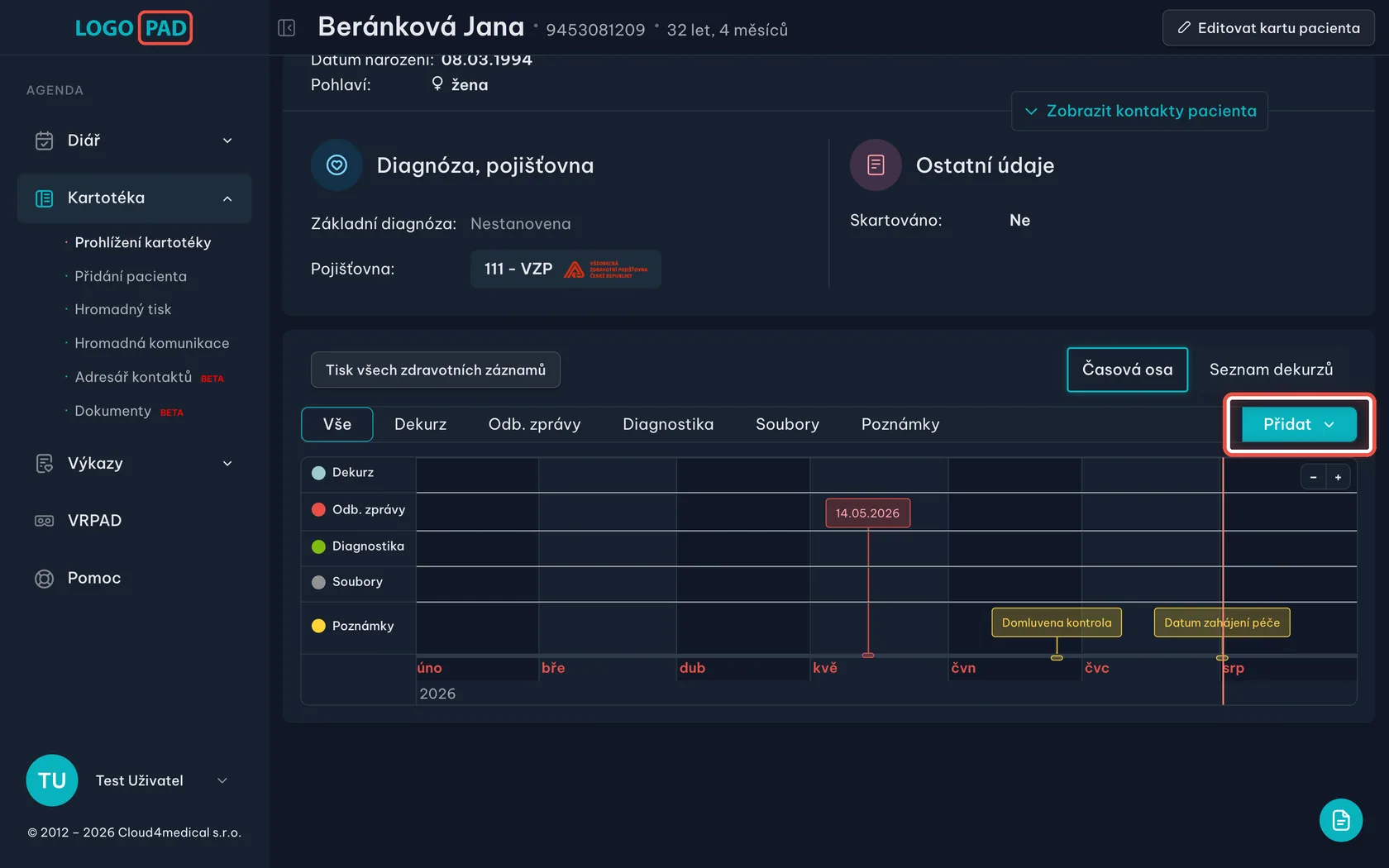 Snímek obrazovky ke kroku 2: Najděte časovou osu